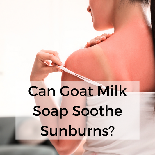 Can Goat Milk Soap Soothe Sunburns? A Dive into Natural Sunburn Relief